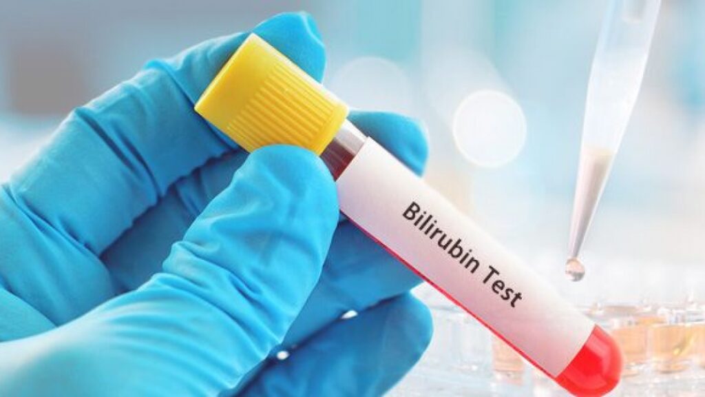 Can Fatty Liver Cause High Bilirubin?